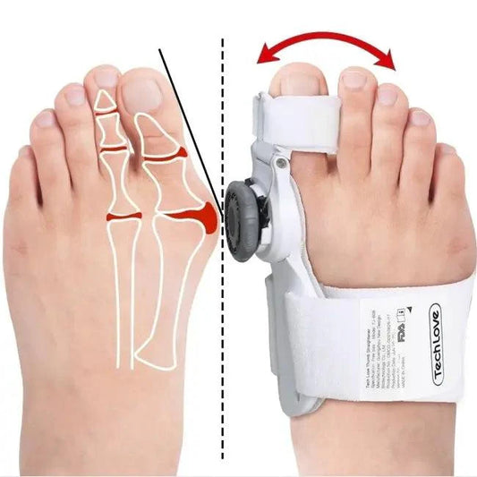 Correcteur Hallux Valgus, Attelle Correctrice d'Oignon